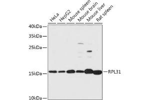 Western blot analysis of extracts of various cell lines, using RPL31 antibody (ABIN7270002) at 1:1000 dilution.