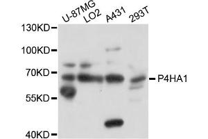 Western blot analysis of extracts of various cells, using P4HA1 antibody. (P4HA1 anticorps)