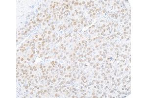 Immunohistochemistry (IHC) image for anti-Runt-Related Transcription Factor 2 (RUNX2) (AA 300-350) antibody (ABIN7795797)