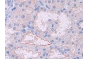 IHC-P analysis of Human Kidney Tissue, with DAB staining. (HFE2 anticorps  (AA 234-416))