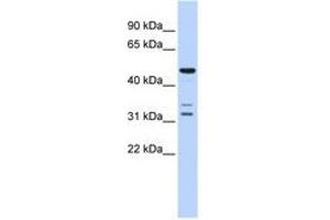 Image no. 1 for anti-HtrA Serine Peptidase 4 (HTRA4) (AA 396-445) antibody (ABIN6741359) (HTRA4 anticorps  (AA 396-445))