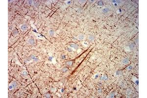 Immunohistochemical analysis of paraffin-embedded human cerebrum tissues using NEFH mouse mAb with DAB staining. (NEFH anticorps  (AA 2-251))