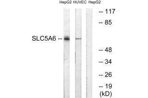 Western blot analysis of extracts from HepG2 cells and HUVEC cells, using SLC5A6 antibody. (SLC5A6 anticorps)