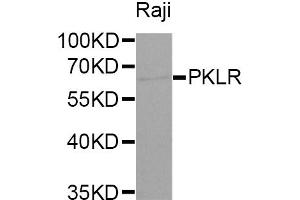 Western blot analysis of extracts of Raji cells, using PKLR antibody (ABIN5970989) at 1/1000 dilution. (PKLR anticorps)
