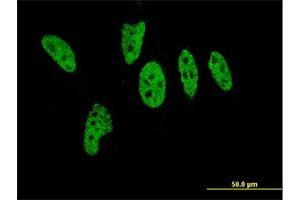 Immunofluorescence of monoclonal antibody to EP300 on HeLa cell. (p300 anticorps  (AA 731-830))