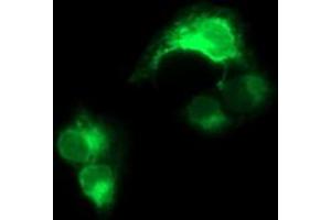 Image no. 3 for anti-CD163 (CD163) antibody (ABIN1497175) (CD163 anticorps)
