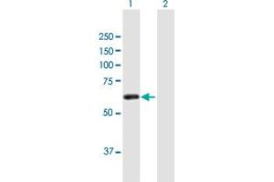 Western Blot analysis of ZSCAN21 expression in transfected 293T cell line by ZSCAN21 MaxPab polyclonal antibody. (ZSCAN21 anticorps  (AA 1-473))