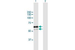 Western Blot analysis of SNX8 expression in transfected 293T cell line by SNX8 MaxPab polyclonal antibody.