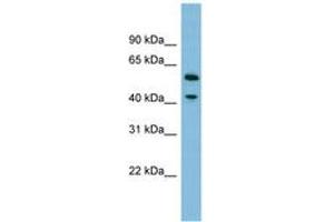 Image no. 1 for anti-Dihydrouridine Synthase 1-Like (DUS1L) (AA 359-408) antibody (ABIN6745180) (DUS1L anticorps  (AA 359-408))