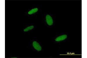 Immunofluorescence of purified MaxPab antibody to ZNF557 on HepG2 cell.