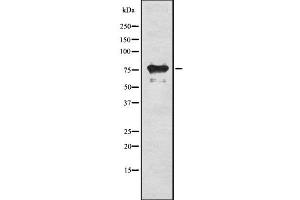 Western blot analysis of RIPK1 using HeLa whole cell lysates (RIPK1 anticorps  (Internal Region))