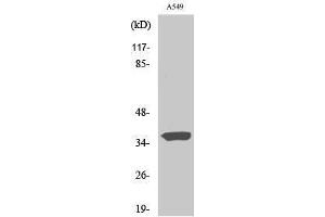 Western Blotting (WB) image for anti-Six Transmembrane Epithelial Antigen of The Prostate 1 (STEAP1) (N-Term) antibody (ABIN3187095) (STEAP1 anticorps  (N-Term))