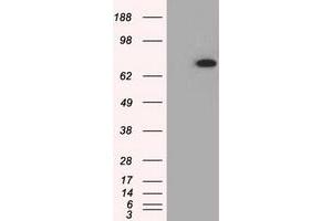 HEK293T cells were transfected with the pCMV6-ENTRY control (Left lane) or pCMV6-ENTRY PDE4A (Right lane) cDNA for 48 hrs and lysed. (PDE4A anticorps)