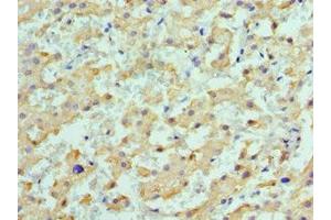 anti-Aldehyde Dehydrogenase 1 Family, Member L1 (ALDH1L1) (AA 1-250) antibody