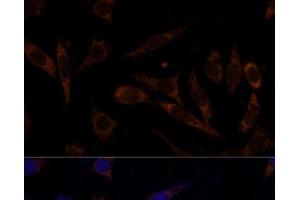 Immunofluorescence analysis of L929 cells using TFRC Polyclonal Antibody at dilution of 1:100 (40x lens).