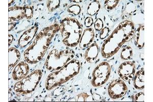 Immunohistochemistry (IHC) image for anti-3-hydroxybutyrate Dehydrogenase, Type 2 (BDH2) antibody (ABIN1496856)