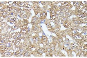 Immunohistochemistry of paraffin-embedded Rat liver using CDK5RAP1 Polyclonal Antibody at dilution of 1:100 (40x lens). (CDK5RAP1 anticorps)