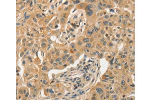 Immunohistochemistry (IHC) image for anti-Solute Carrier Family 11 (Proton-Coupled Divalent Metal Ion Transporters), Member 2 (SLC11A2) antibody (ABIN2434564) (SLC11A2 anticorps)
