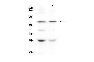 Western blot analysis of DPYD using anti-DPYD antibody . (DPYD anticorps  (AA 356-511))