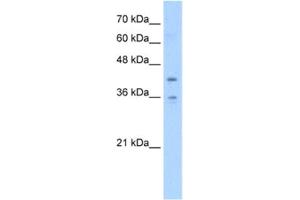 Western Blotting (WB) image for anti-Transmembrane Protein 104 (TMEM104) antibody (ABIN2463056) (TMEM104 anticorps)