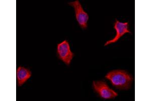 ABIN6263798 and ABIN6272368 staining Hela by IF/ICC.