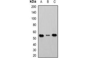 Western blot analysis of Cbl-3 expression in HEK293T (A), Raji (B), mouse kidney (C) whole cell lysates. (CBLC anticorps)