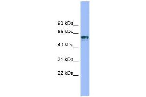 IL18R1 antibody used at 1 ug/ml to detect target protein. (IL18R1 anticorps  (N-Term))