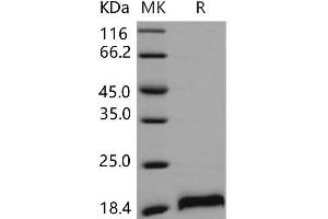 Western Blotting (WB) image for Cerebral Dopamine Neurotrophic Factor (CDNF) protein (His tag) (ABIN7320230)