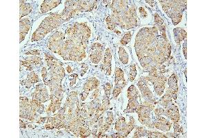 IHC analysis of PPT1 using anti PPT1 antibody (ABIN6719501).