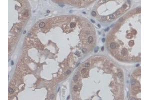 Detection of CD300c in Human Kidney Tissue using Polyclonal Antibody to CD300 Antigen Like Family Member C (CD300c) (CD300c anticorps  (AA 21-183))