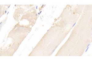 Detection of ERK2 in Rat Skeletal muscle Tissue using Polyclonal Antibody to Extracellular Signal Regulated Kinase 2 (ERK2)