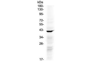 Western blot testing of human COLO320 cell lysate with NDRG3 antibody at 0. (NDRG3 anticorps)
