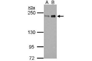 WB Image Sample (30 ug of whole cell lysate) A: 293T B: HeLa 5% SDS PAGE antibody diluted at 1:1000 (ZEB1 anticorps)