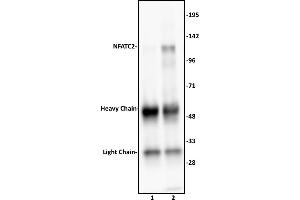NFATC2 antibody (pAb) tested by Immunoprecipitation.