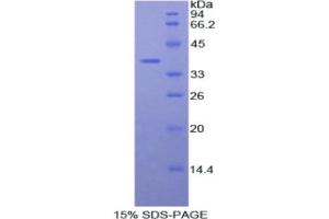 SDS-PAGE analysis of Human Fibulin 4 Protein. (FBLN4 Protéine)