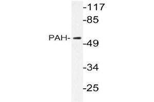 Western blot (WB) analyzes of PAH antibody in extracts from HepG2 cells. (Phenylalanine Hydroxylase anticorps)