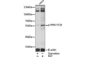 Western blot analysis of extracts of HeLa cells, using Phospho-Paxillin-Y118 antibody (ABIN3019661, ABIN3019662, ABIN3019663 and ABIN1681980) at 1:2000 dilution. (Paxillin anticorps  (pTyr118))