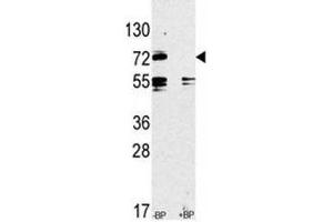 Western blot analysis of anti-TLR2 antibody pre-incubated without and with blocking peptide in CEM lysate (TLR2 anticorps  (AA 720-749))