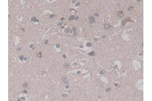 Detection of RALA in Human Cerebrum Tissue using Monoclonal Antibody to V-Ral Simian Leukemia Viral Oncogene Homolog A (RALA) (rala anticorps  (AA 1-206))