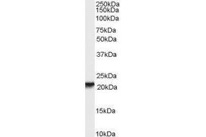Western Blotting (WB) image for Retinol Binding Protein 4, Plasma (RBP4) (Internal Region) peptide (ABIN368935) (Retinol Binding Protein 4, Plasma (RBP4) (Internal Region) Peptide)