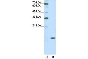 WB Suggested Anti-SNRPD1  Antibody Titration: 0. (SNRPD1 anticorps  (N-Term))
