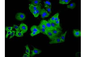 Immunofluorescence staining of HepG2 cells with ABIN7163713 at 1:33, counter-stained with DAPI. (Plexin C1 anticorps  (AA 81-218))
