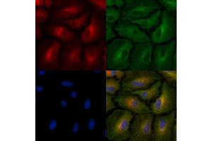 ABIN6264355 and ABIN6278163 staining  cells by IF/ICC.