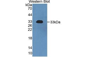 Western blot analysis of the recombinant protein. (UBAP1 anticorps  (AA 1-224))