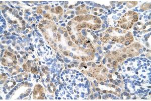 Human kidney (SLC22A3 anticorps  (N-Term))