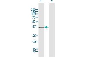 Western Blot analysis of HSD17B2 expression in transfected 293T cell line by HSD17B2 MaxPab polyclonal antibody.