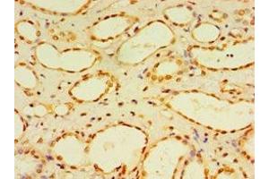Immunohistochemistry of paraffin-embedded human kidney tissue using ABIN7150785 at dilution of 1:100 (DUSP7 anticorps  (AA 160-419))