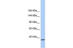 WB Suggested Anti-SMARCAD1 Antibody Titration:  0. (SMARCAD1 anticorps  (N-Term))