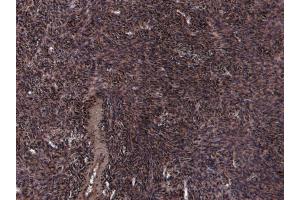 (ABIN185600) (8 μg/mL) staining of paraffin embedded Human Ovary. (Oxytocin Receptor anticorps  (Internal Region))