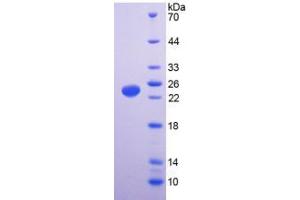 SDS-PAGE analysis of Human TRPV1 Protein. (TRPV1 Protéine)